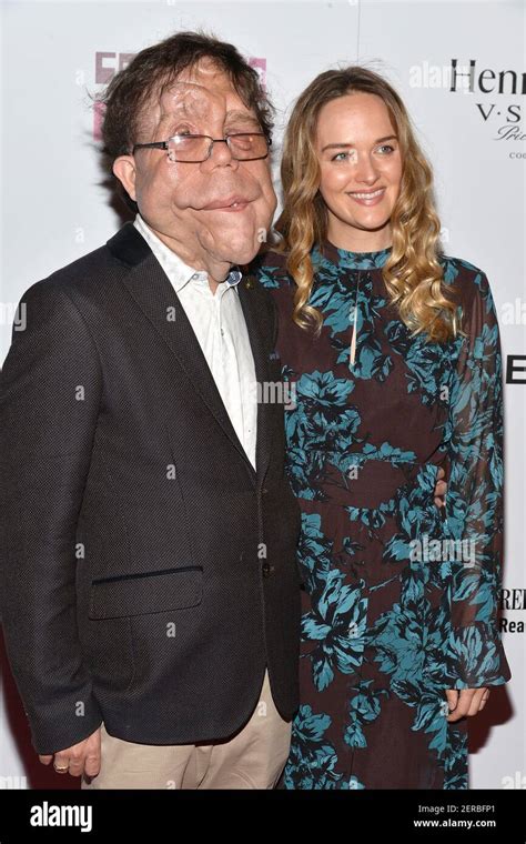 Adam Pearson Wife